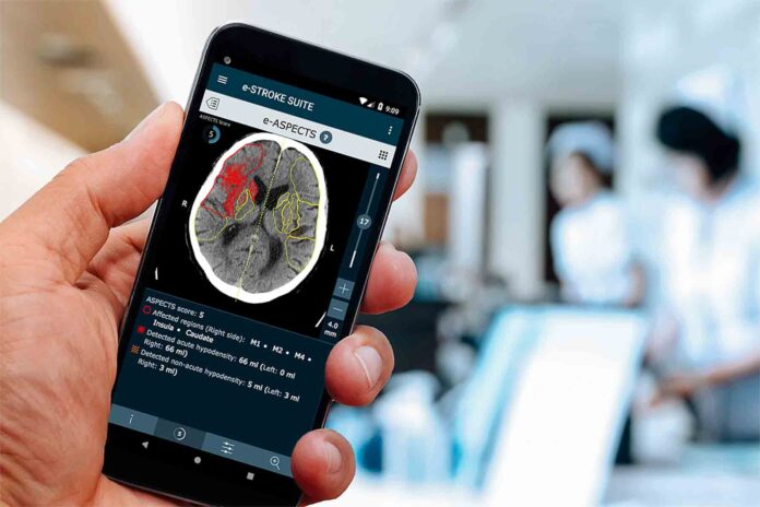 AI-saving-lives-Brainomix AI-saving-lives-Brainomix